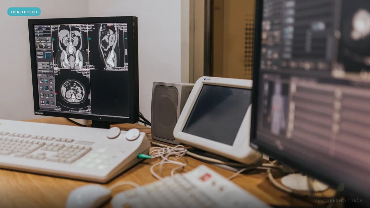 Radiology workstation monitor showing abdominal CT scans, with keyboards and a second screen on a wooden desk