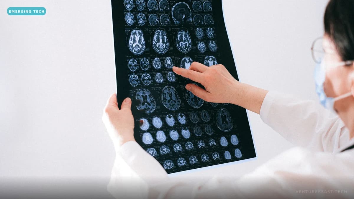 A clinician in a white coat pointing at a sheet of brain scan images held up to the light